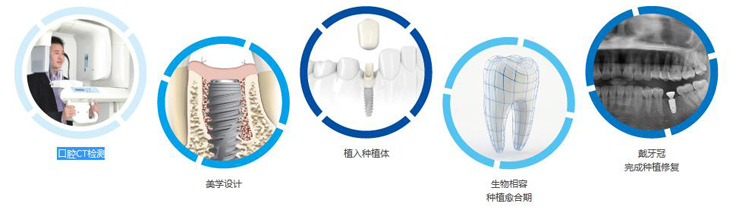 种植牙过程