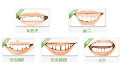 金属托槽矫正技术